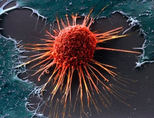 Trudno przytoczyć konkretne fotografie, myślę jednak, że rak szyjki macicy i virus hpv zadośćuczyni za mikro i makro kosmos. Trudno przytoczyć konkretne fotografie, myślę jednak, że rak szyjki macicy i virus hpv zadośćuczyni za mikro i makro kosmos.